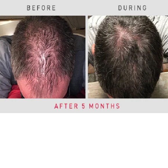 IRestore ID-500 Essential - Picture 13 of 13